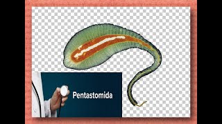 Pentastomida quotTongue wormsquot and Pentastomiasis Dr Manar Elmehankar [upl. by Ardua517]