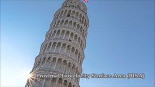 Proximal Isovelocity Surface Area PISA [upl. by Atteuqihc944]