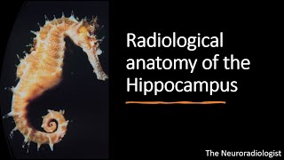 Unforgettable Radiological Anatomy of the Hippocampus [upl. by Arne821]