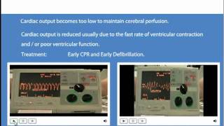 Advanced Life Support Shockable and Non Shockable Rhythms [upl. by Enomis]