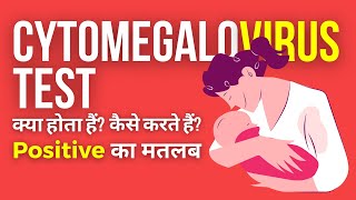 Cytomegalovirus IgG Test in Hindi  CMV IgG Test Positive क्या होता है [upl. by Teragram251]