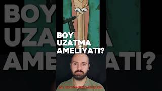 Boy Uzatma Ameliyatı Nedir Nasıl Yapılır [upl. by Aeriela]