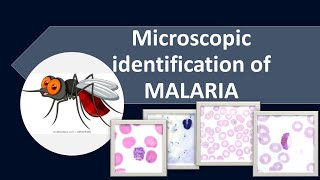 Malaria identificationMalariaMLSMalarialifecycleMalariapathogenesismedilabcademy [upl. by Nessnaj609]