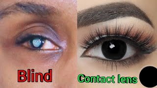 ব্লাইন্ড কি Blind Contact Lens কেন ব্যবহার করবেনEgo vision Blind contact lens [upl. by Bernice]