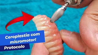 FAZENDO CEROPLASTIA EM UM PROTOCOLO DENTÁRIO Utilizando broca [upl. by Frear]