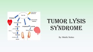 Tumor lysis syndrome  definition clinical features treatment prevention [upl. by Nosneh632]