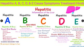 Complete Hepatitis  Hepatitis A B C D amp E Cause Symptoms Diagnosis Treatment Hindi Hepatitis [upl. by Inoek]