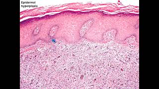 2021 Classic Lectures in Pathology What You Need to Know Soft Tissue Pathology  A CME Activity [upl. by Takken678]