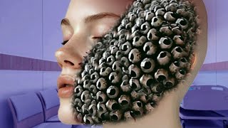 ASMR 2D Animation Treatment  Face Remove Dog Ticks and Trypophobia Infected [upl. by Nahgeam]