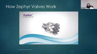 Zephyr Endobronchial Valves A treatment to reduce hyperinflation in patients with severe emphysema [upl. by Cyrie570]