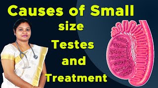 Causes of Small volume testis and treatment  DrPIswarya Devi MDs [upl. by Anivlac]