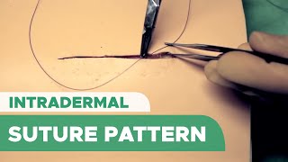 Intradermal Suture Pattern Subcuticular Suture – Intracutaneous Suture [upl. by Can]