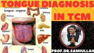 TONGUE DIAGNOSIS IN TCM [upl. by Acilejna291]