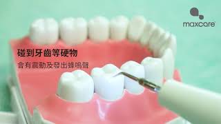 ION Sonic Tooth Cleaner 超聲波離子洗牙器 [upl. by Stambaugh]