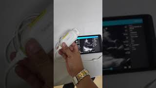 handheld ultrasound Philips lumify [upl. by Hamrnand]