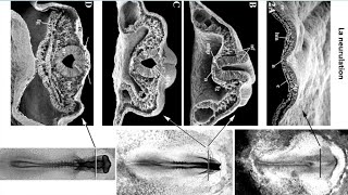 La troisième semaine du développement embryonnaire deuxième partie La neurulation [upl. by Aigneis]