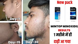 सिर्फ 1 महीने के अंदर ही दाढ़ी उगाए  इन तरीकों से  mintop minoxidil 5 beard  minoxidil beard [upl. by Trudey240]