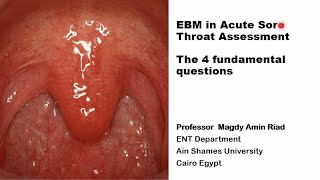 EBM in Acute Sore Throat Assessment The 4 fundamental questions [upl. by Bocaj]