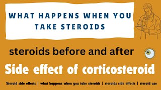 Steroid side effects  what happens when you take steroids  steroids side effects  steroid use [upl. by Laira]