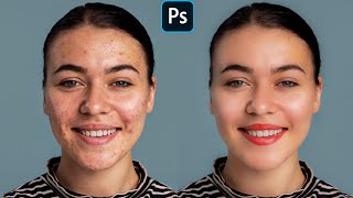 Face Retouching  Best Photoshop Tutorial  Skin Retouching [upl. by Ifok388]