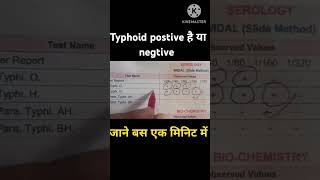 Widal test report देखे बस एक मिनिट में  widaltestreport widaltest widal typhoid typhoidfever [upl. by Loise]