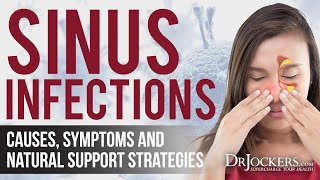 Top 8 Sinus Infection Natural Remedies [upl. by Rozanne52]