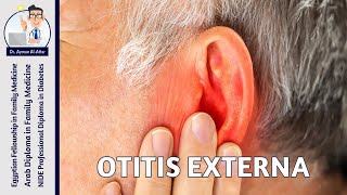 Otitis Externa [upl. by Keiko506]