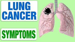 Lung Cancer  All Symptoms [upl. by Kelwunn]