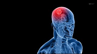 Unlocking Glioblastoma Treatment anticancer drug conjugate kills glioblastoma cells [upl. by Adarbil]