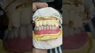 Lower Soft Denture Ready For Flasking softdenture completedenture dentalartbyhaider [upl. by Harneen]