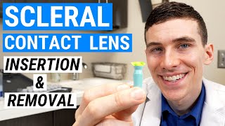 How to Insert and Remove SCLERAL LENSES  Beginners Guide to Scleral Lenses [upl. by Yarezed213]