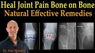 Heal Joint Pain Bone on Bone  Dr Alan Mandell DC [upl. by Eilla]