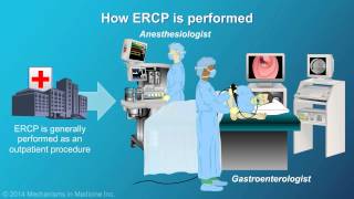 Understanding ERCP Endoscopic Retrograde Cholangiopancreatography [upl. by Girish]