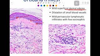 MSS pathology lab 1  part 1 [upl. by Melisa914]