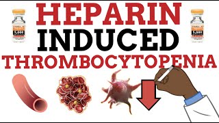 Heparin Induced Thrombocytopenia HIT MADE EASY [upl. by Fruin]