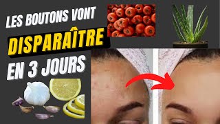 Comment éliminer les boutons du visage rapidement en 3 jours ≠4Astuces très efficaces [upl. by Farland]