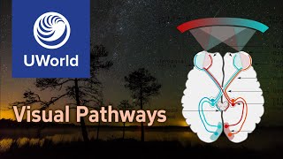 Visual PathwaysOptic Nerve PathwayVision  USMLE Step 1 UWorld Questions MBBS Ophthalmology [upl. by Nemlaz]