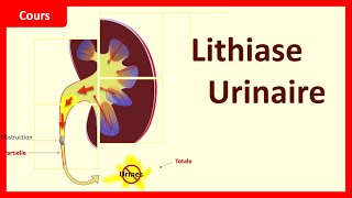 Lithiase urinaire 💧  questce que cest  🧐  Cours  UroNephrologie [upl. by Einatsed]