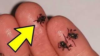 Man Thought He Had Bed Bugs Expert Stops Cold After Realizing What They Actually Are [upl. by Dorfman766]