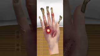 Hand hole remove and cleaning  Finger ring remove  viral animation skincare makeupanimation [upl. by Enrichetta]