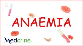 Anemia  causes classification clinical features treatment [upl. by Bromleigh]