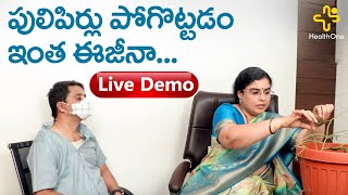 పులిపిర్లు పోగొట్టడం ఇంత ఈజీనా Unani Treatment for Warts  by Dr SGV Sathya  TeluguOneHealth [upl. by Gold]