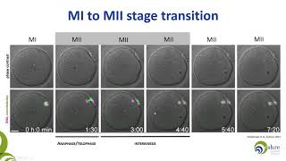 The importance of being mature Oocyte maturity assessment in clinical practice [upl. by Winifield481]