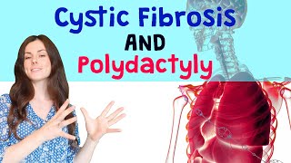 CYSTIC FIBROSIS and POLYDACTYLY GCSE Biology 91  Combined Revision amp Qs [upl. by Procto241]