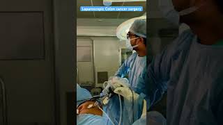 Laparoscopic colon cancer  dr Amit Acharya  Billroth Gastrosurgery centre Rajkot [upl. by Ailhat]