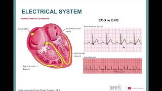 Cardiac Amyloidosis A Patient’s Perspective [upl. by Eceirahs647]