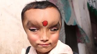 Boy With Mystery Condition Is Worshipped As A God [upl. by Poler]