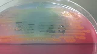 Colony morphology of Citrobacter freundii on CLED Agar [upl. by Cassandre]