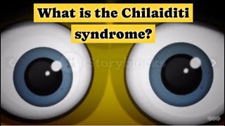 What is the Chilaiditi syndrome [upl. by Ocirnor541]