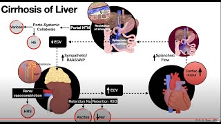 LiverCirrhosisAscites1cPathophysiology [upl. by Agueda]